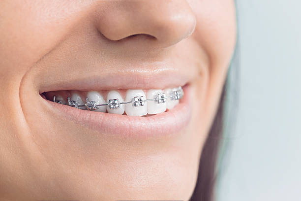 Best Invisalign and Clear Aligners  in Pacheco, CA